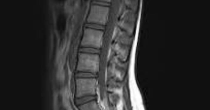 My MRI Was Normal But I’m Still in Pain.......What Now? image