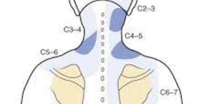 The Real Reason Your Shoulder Blade Pain Won't Go Away image